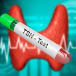 تحليل TSH كيف تقرأ تحليل الغدة الدرقية