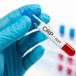 ماهو تحليل CRP والنتائج الطبيعية للتحليل