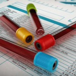 ماهو تحليل MCV ؟ وماهي النسب الطبيعية لتحليل MCV ؟