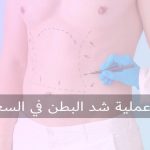 سعر عملية شد البطن في السعودية